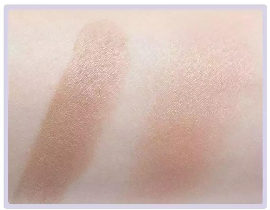 日本小脸矫正手法,日本小脸整形手术