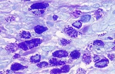 关于EGC身为铲屎官的你知多少?各种皮肤病都可能是EGC!