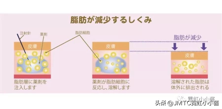 日本小姐姐针灸瘦脸视频,小姐姐打瘦脸针视频