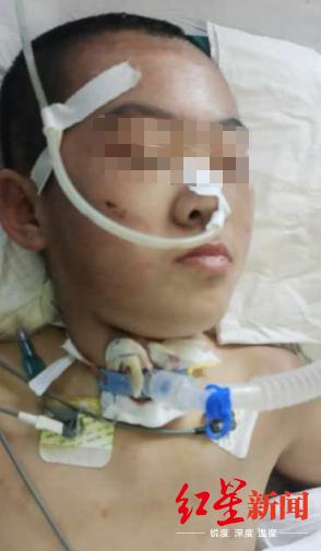 3岁女童遭继母虐待身亡后续,12岁女孩遭继母虐待脑死亡