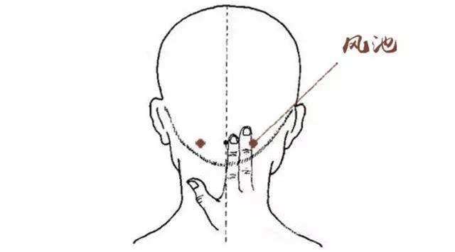 风池穴疼痛针灸什么穴位,风池穴疼痛艾灸哪个穴位