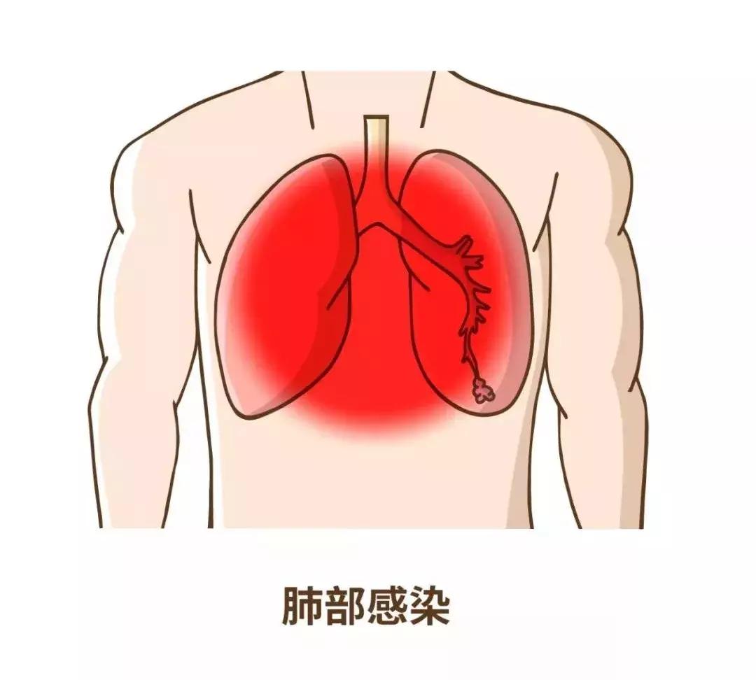 摔跤会死人吗,老年人为什么摔跤致命