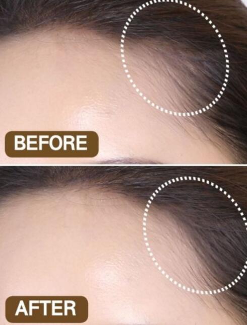 头发细软贴头皮怎么改善,头发细软贴头皮