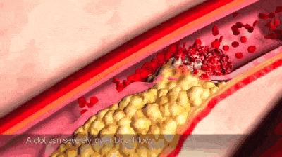 不想去医院第二弹！胸部不适的自我诊察