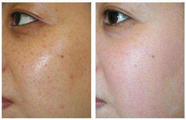 哪一款的面霜最好用,平价面霜公认最好用的是哪款