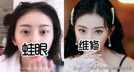 平行式双眼皮变成普通窄双眼皮了,悲伤蛙双眼皮图片