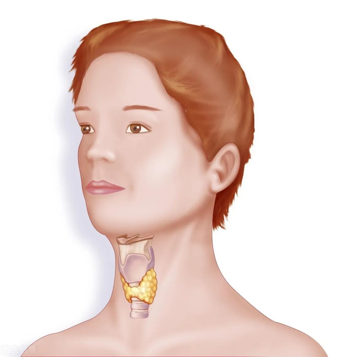 40岁女因脾气暴躁2次手术，最后一次差点毙命，医生切开她喉咙