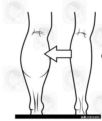 肾的什么问题会引起腰痛,什么症状腰痛是肾不好引起的