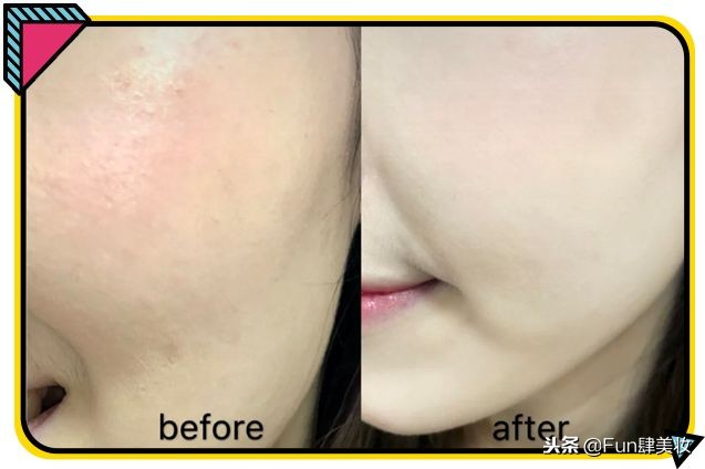 用粉底总是起皮用什么比较服帖,卡粉严重还是不化妆严重