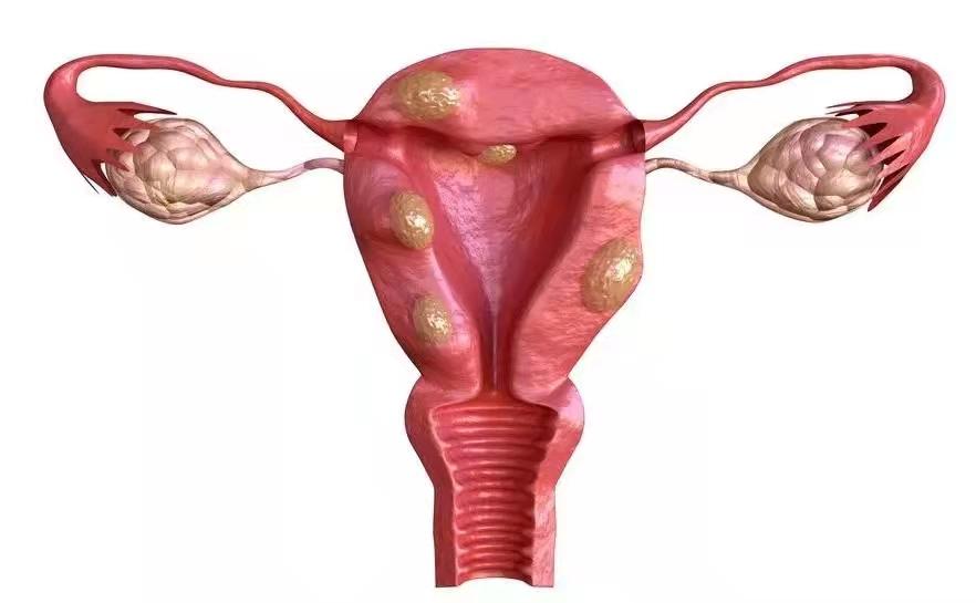 月经不正常应该检查哪些,月经不正常检查又正常是怎么回事