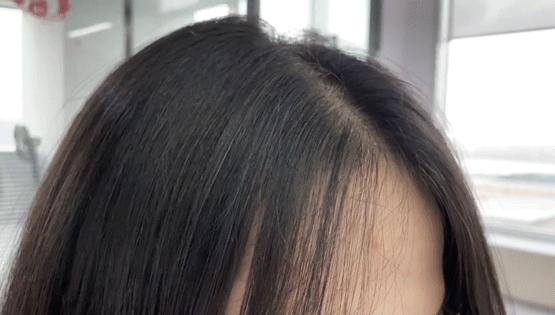 叹头部SPA!拒做人间“油”物,解锁防秃养发小妙招