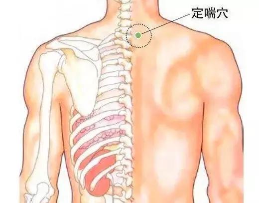治哮喘病的最佳穴位,治哮喘的穴位及方药