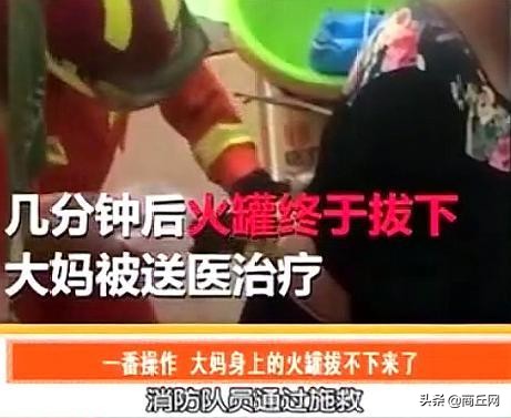 大妈在街头拔火罐,大妈拔火罐