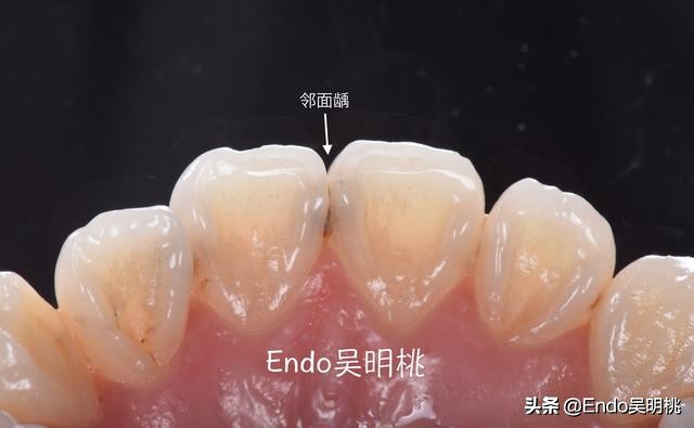 雾里看花墙布,雾里看花找枯枝