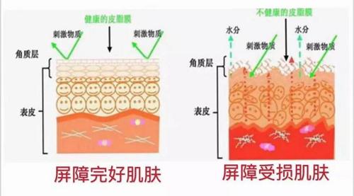 婴儿时光机美白,婴儿时光肌