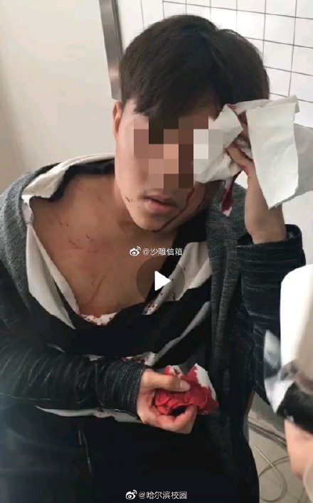 沈理工学生校内被刺凶手,沈大捅伤同学事件三人被刑拘