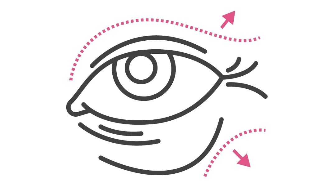 眼霜去眼纹的最好方法,眼纹严重适合的眼霜怎么去掉