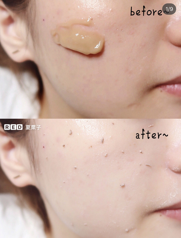 孙艺珍的颜值变化,孙艺珍颜值巅峰的笑容