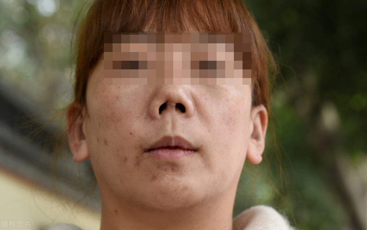 整容不一定能改变命运,整容整形真实经历