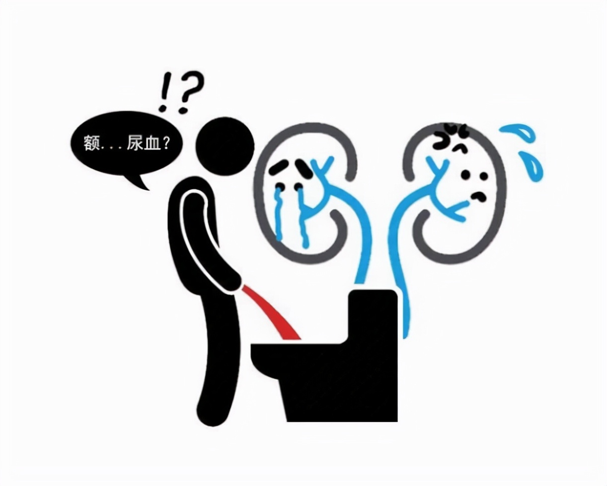 尿路结石碎石对肾危害有多大,尿路结石对泌尿系统的危害有