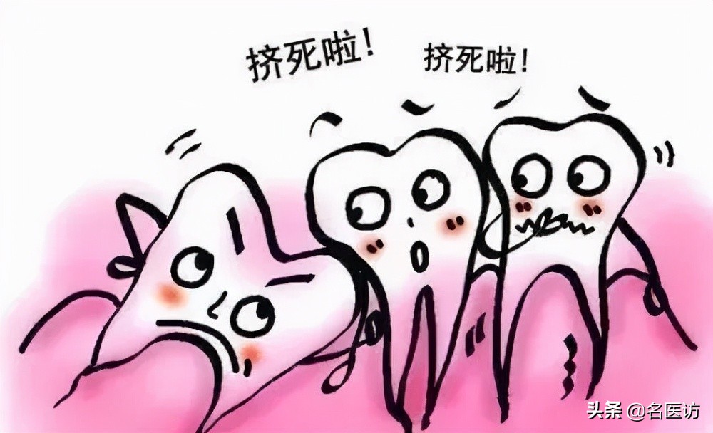 矫正牙齿医生叫打骨钉可以不打吗,正畸打骨钉当天就要挂橡皮筋了吗