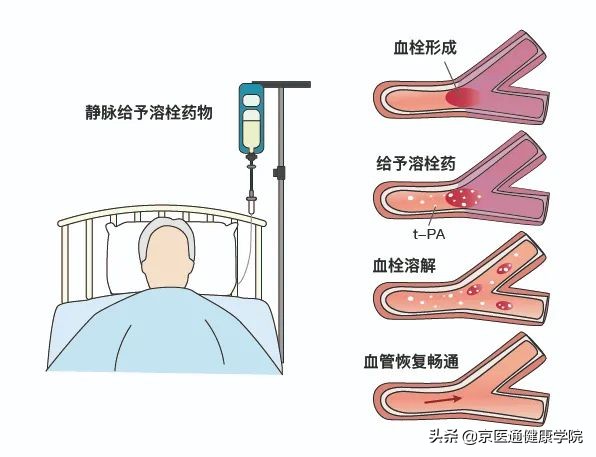 安宫牛黄丸神药吗,安宫牛黄丸是救命仙丹吗
