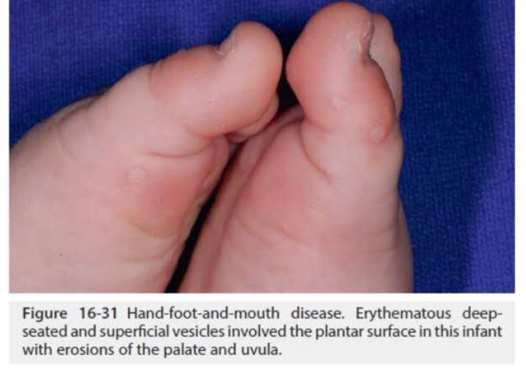 宝宝指甲有白斑倒刺缺什么元素,孩子指甲出白点是缺钙吗