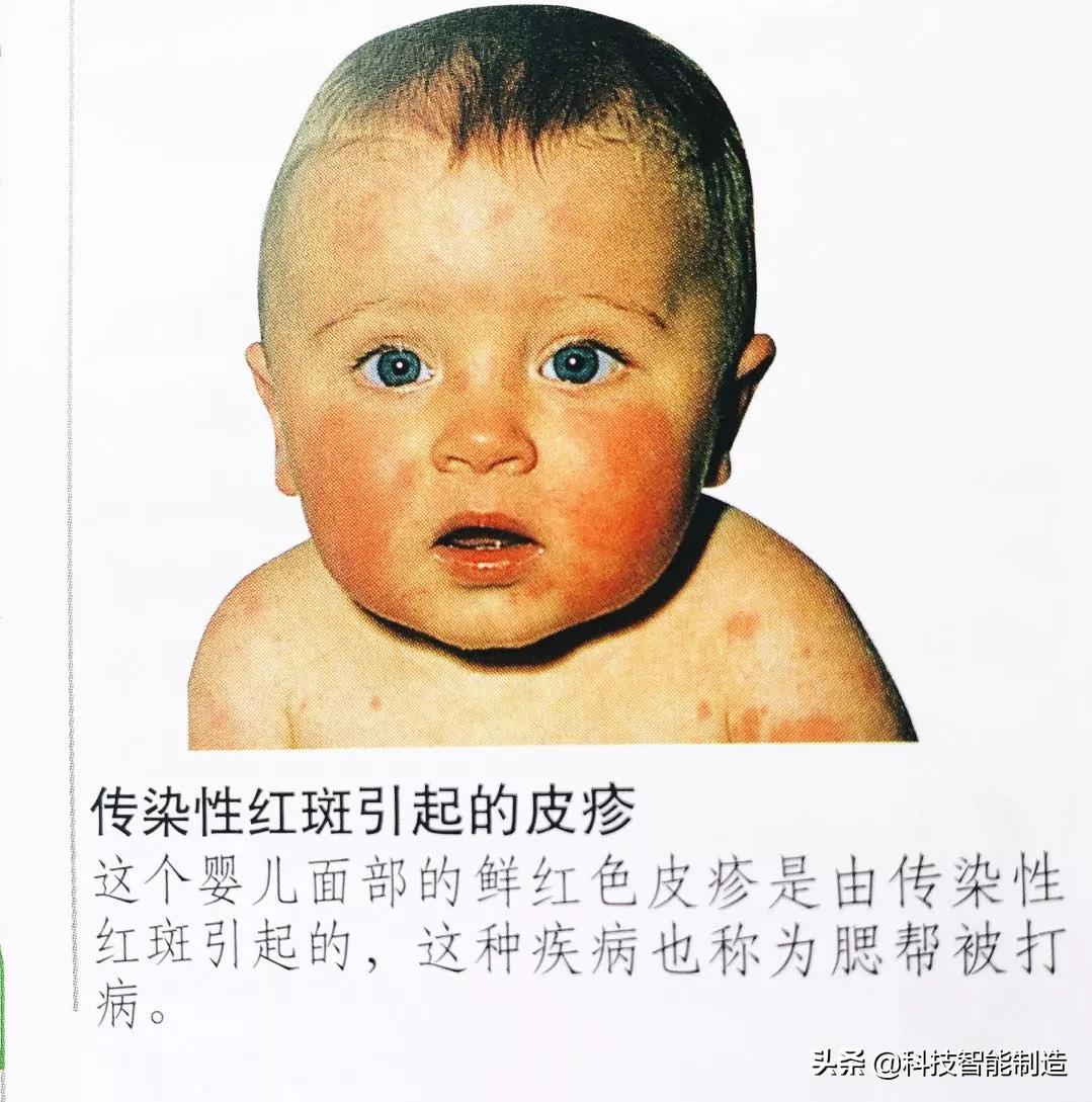 给家人宣讲健康知识记录,给父母科普健康知识小品