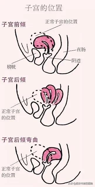 生育后对子宫的影响,生育背后的真相