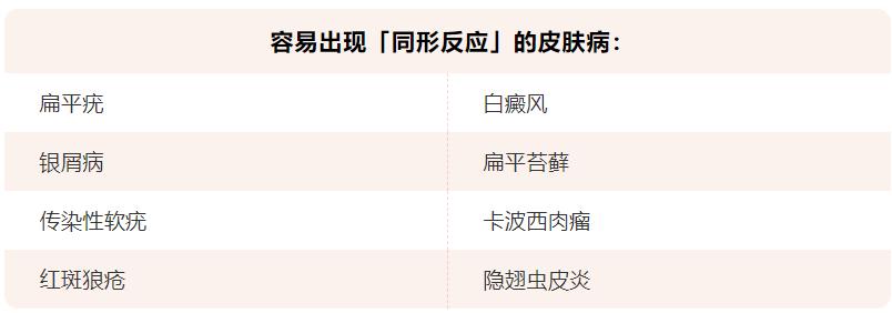 缓解皮肤瘙痒最有效的方法,皮肤瘙痒口服什么止痒药