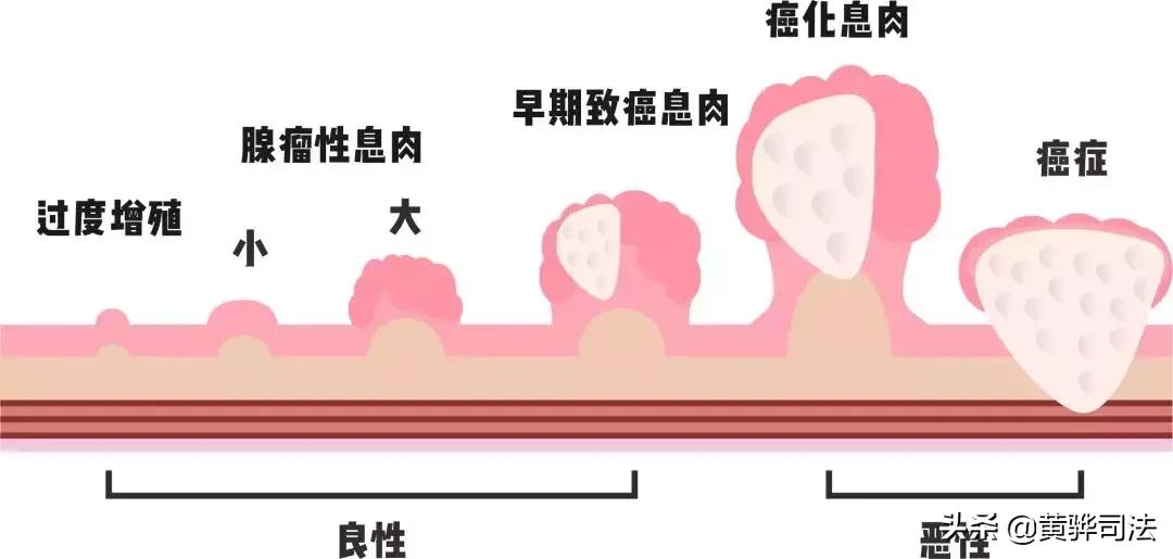 身体有结节囊肿息肉吃什么中成药,身上长囊肿结节息肉是怎么回事