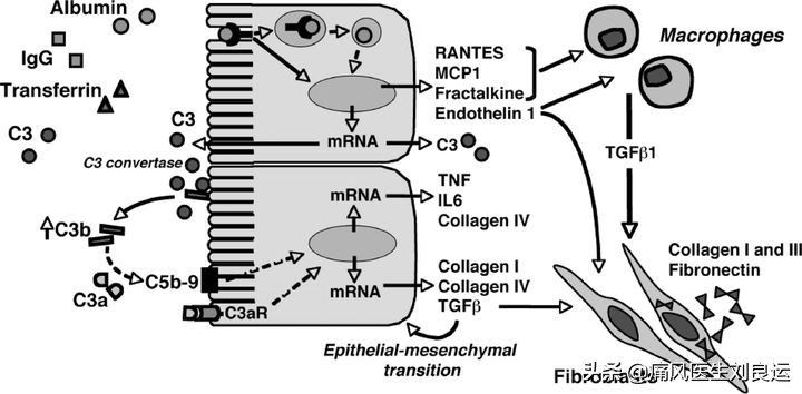 痛风发作吃什么药又不损肾,喝痛风药伤肾喝什么缓解