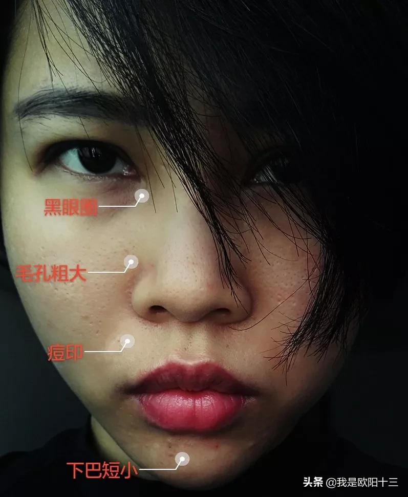 长痘肤色暗沉怎么办小妙招,熬夜皮肤闭口长痘怎么调理