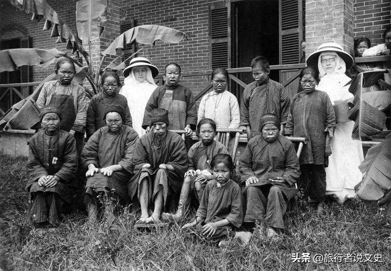 卢照邻麻风病,唐代孙思邈治过卢照邻的麻风病吗