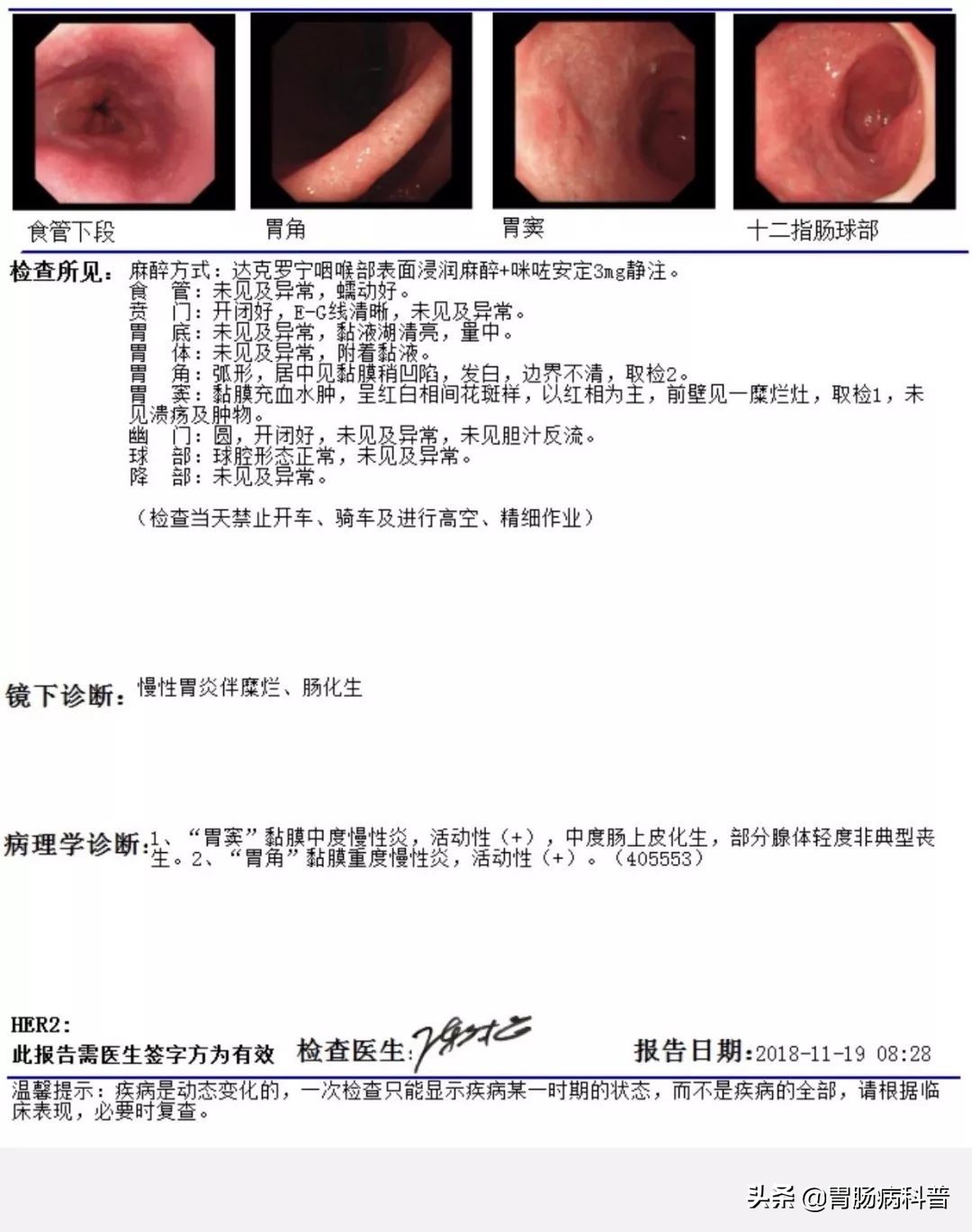 慢性浅表性胃炎伴糜烂还肠化生,肠化生伴轻度异型增生能治愈吗