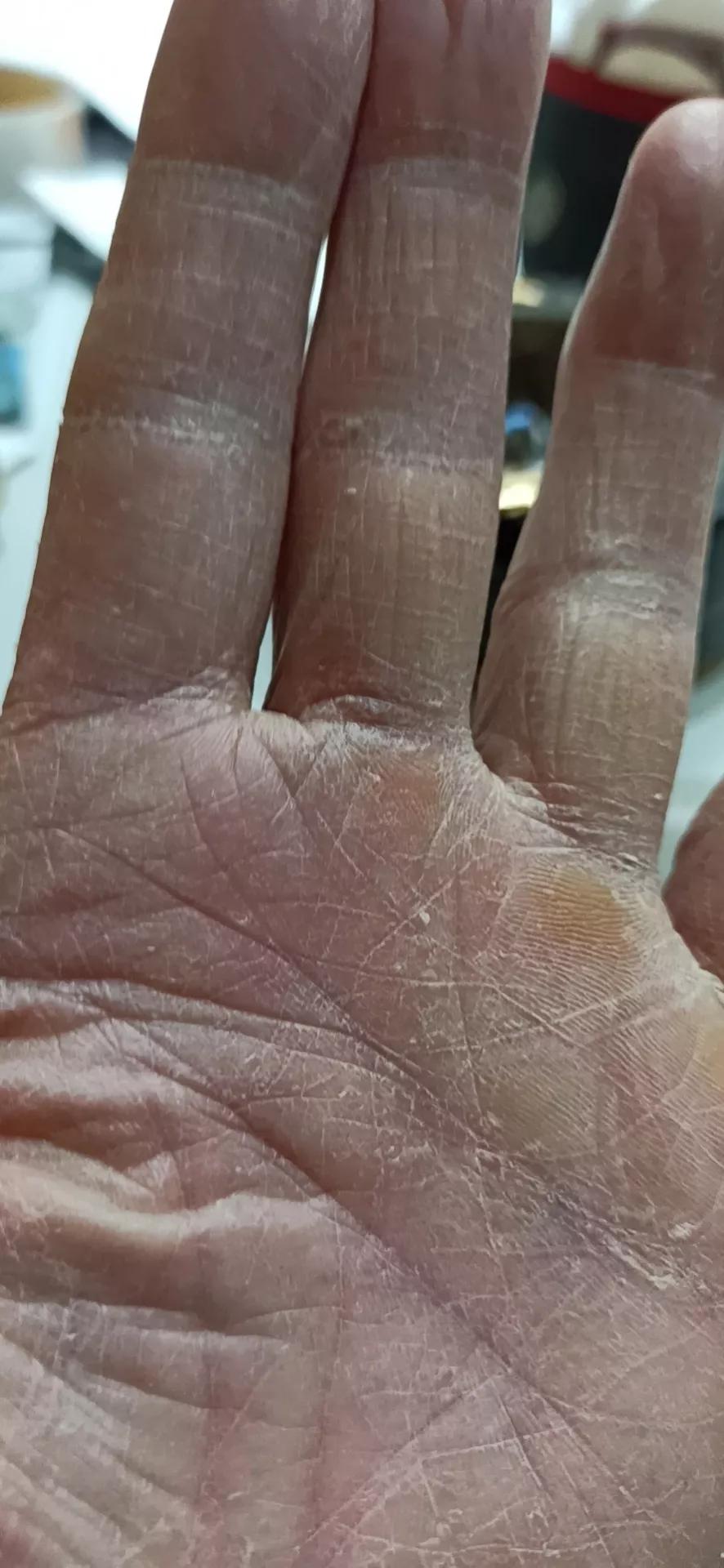 一个0感染0疑似0发热的小区,背后有位“陈经理”