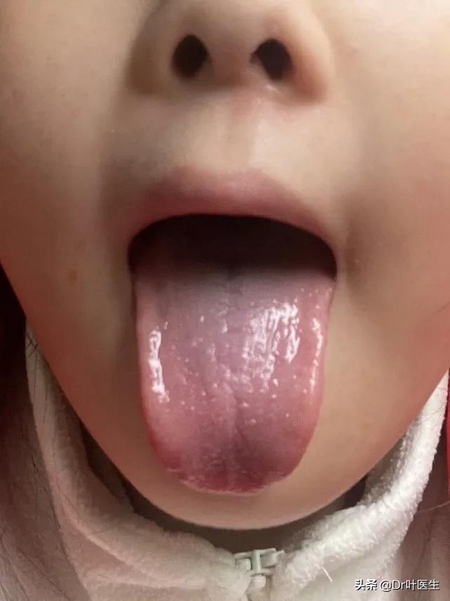 倪海厦感冒十大方剂,小孩感冒中药配方