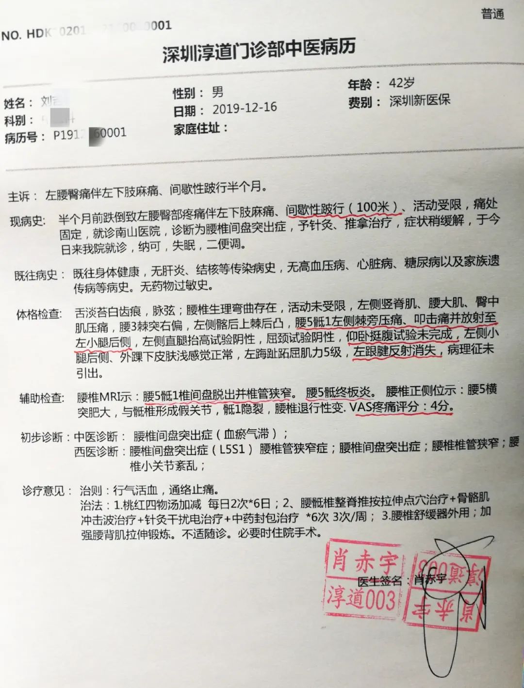 腰椎间盘突出症治疗,1个反射动作引出,提示治愈,医生很开心
