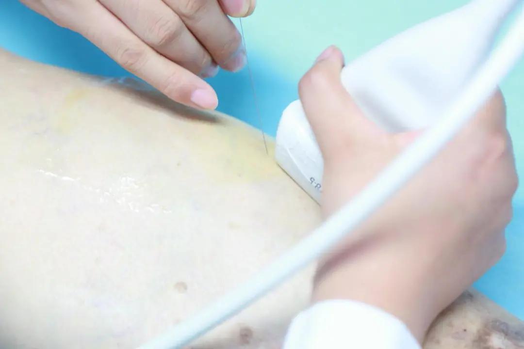 祖传秘方治颈肩腰疼,现代名中医治疗颈肩腰腿痛绝技