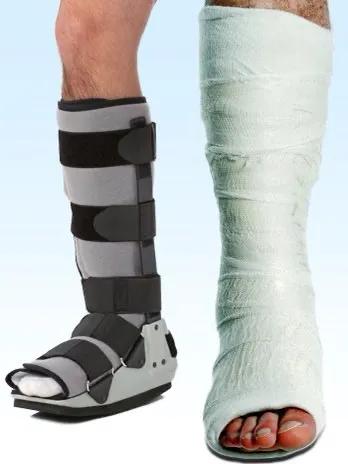 急性跟腱断裂怎么治疗