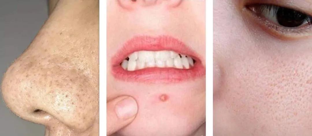 最好用的水乳没有之一,最好用的水乳套装排名