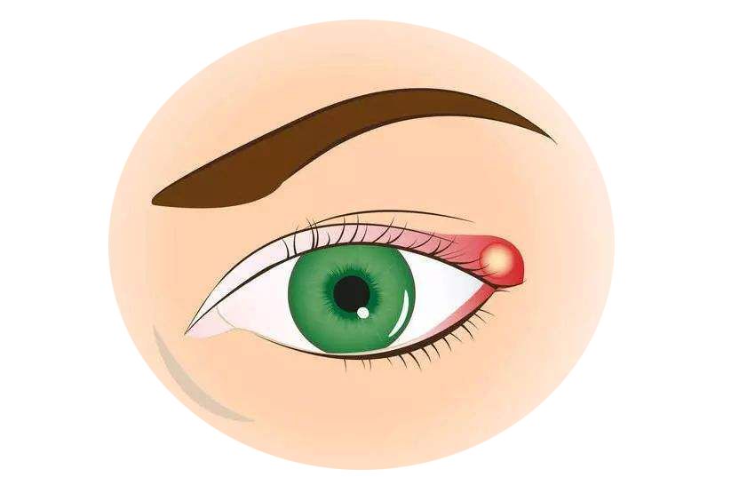 看不好的东西真的会长针眼吗,长针眼是看见不该看到的东西了吗