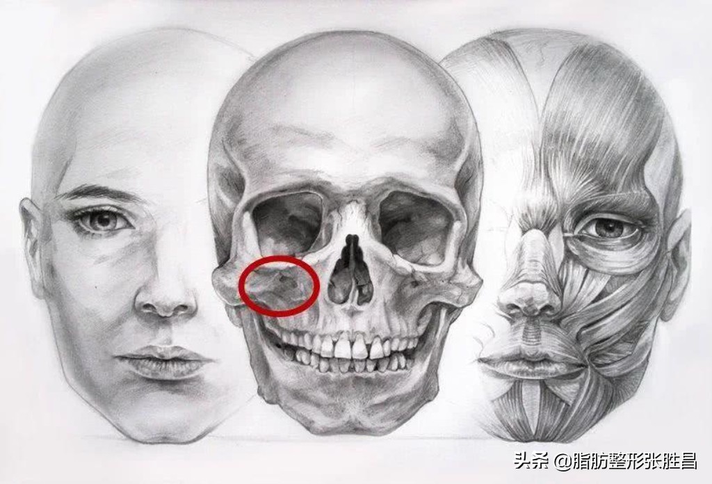 颧骨突出显凶怎么改善,脸凹显凶