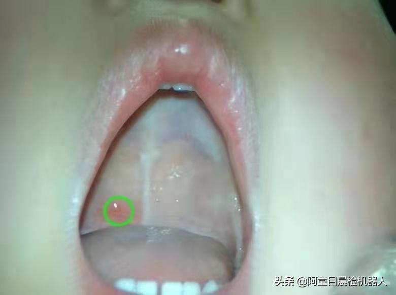 幼儿晨检口腔检查注意事项,阿童目智能晨检机器人晨检功能