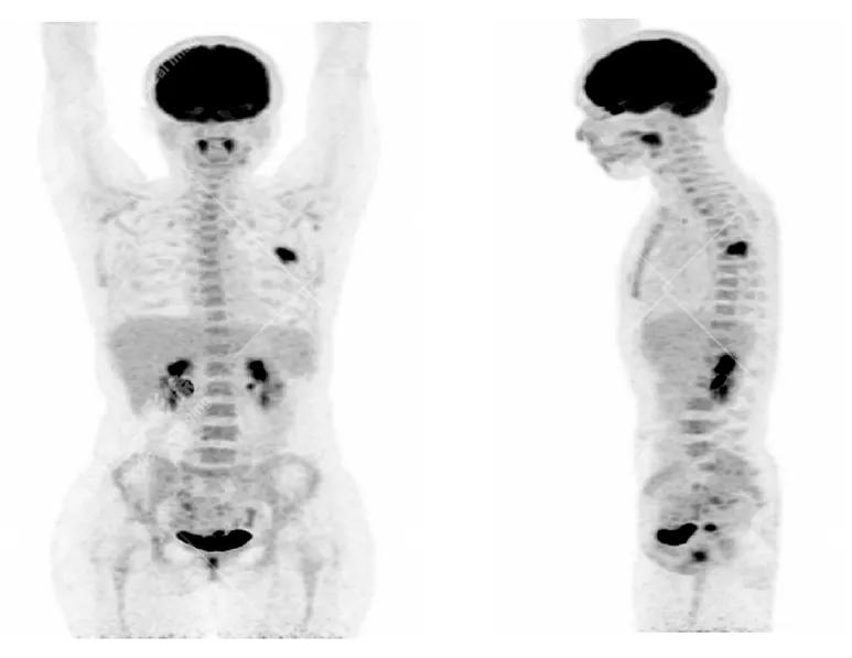 女性防癌检查科普,妇女宫颈癌及乳腺癌筛查情况年报