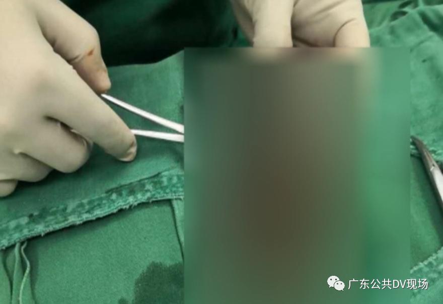 拖不起!男孩突然“蛋疼”不止,隔天送医被切除