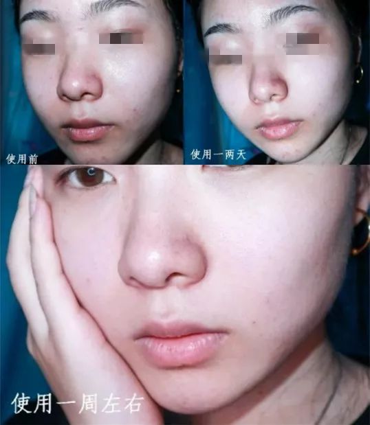 一年四季都能用的保湿面霜,皮肤干推荐一款好用的面霜