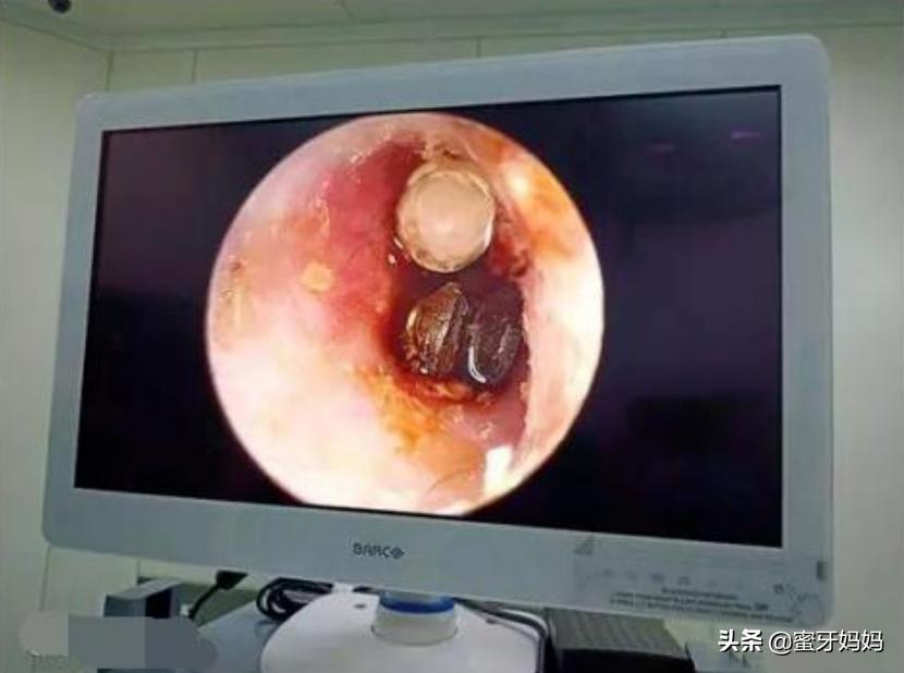 3-6岁孩子正确穿衣,小孩夜间穿衣法则