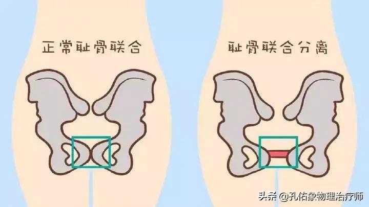 生过孩子女生体验分娩痛,生过孩子的女人老是腰痛