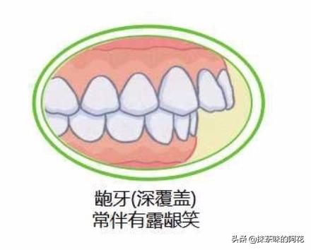 小孩子常见牙齿问题有哪些,孩子牙齿出现问题该不该去医院